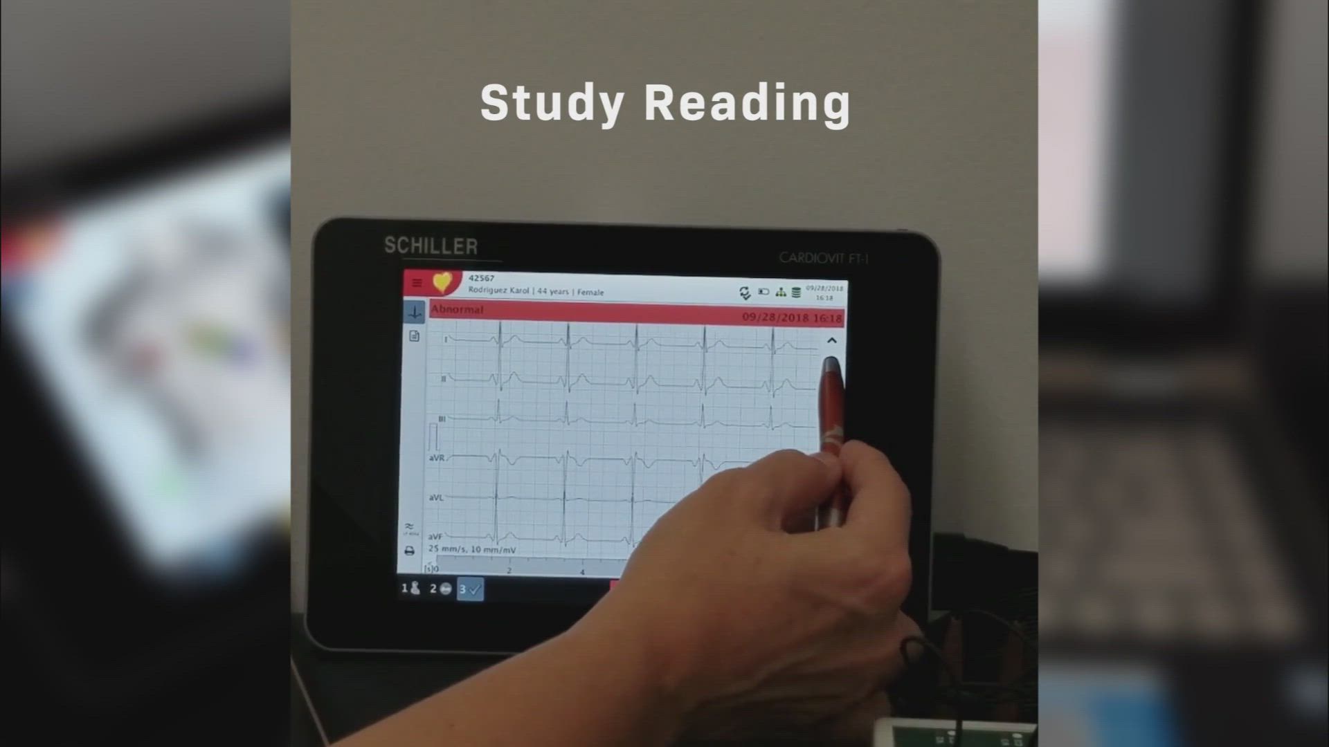 ECG Machine Schiller Cardiovit FT-1 in Delhi at ₹ L ₹