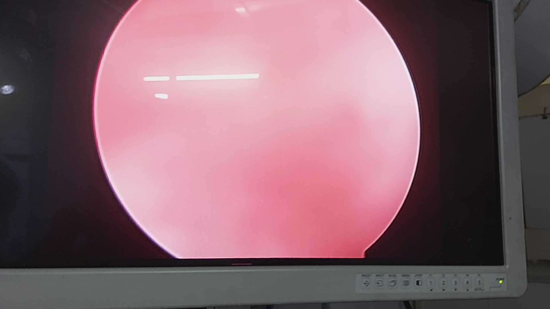 Dr. Rakesh Kumar in Behra Enclave,Delhi Book Appointment Online Best Hip Replacement